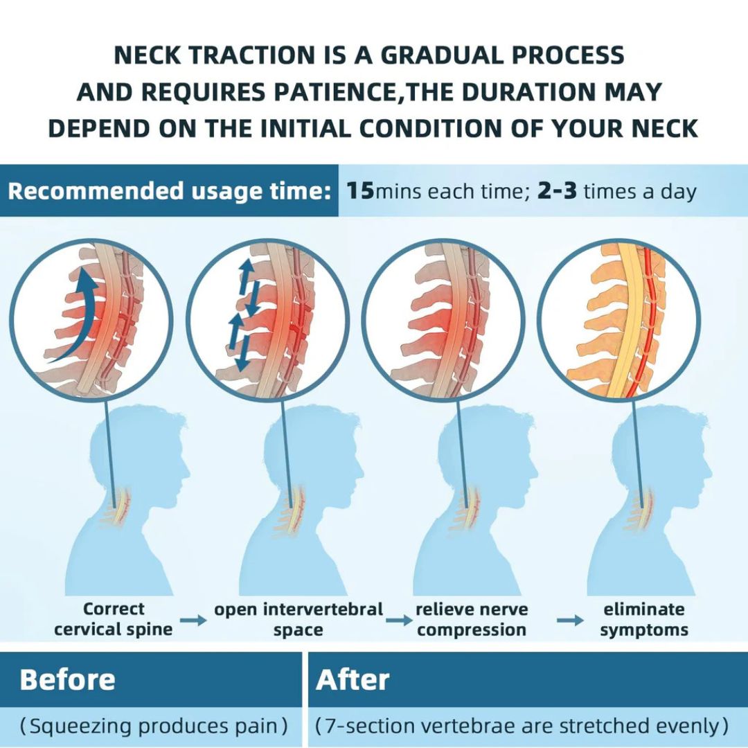 Adjustable Neck Traction Device for Cervical Pain and Tension Relief