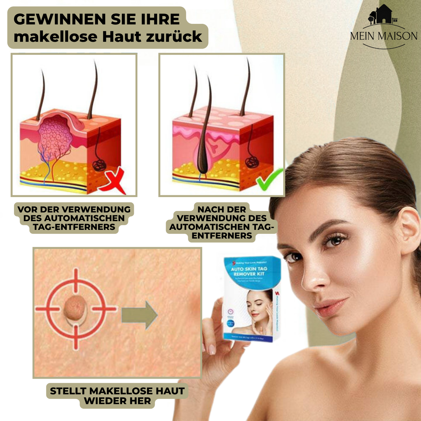 Pain-Free Wart & Mole Remover for Home Use | No Surgery Needed