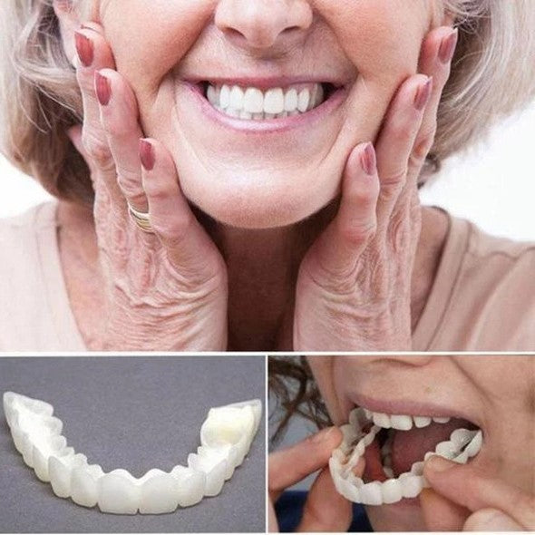 On Smile Veneers for Perfect Teeth (Upper and Lower Included)