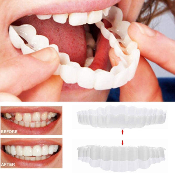 On Smile Veneers for Perfect Teeth (Upper and Lower Included)