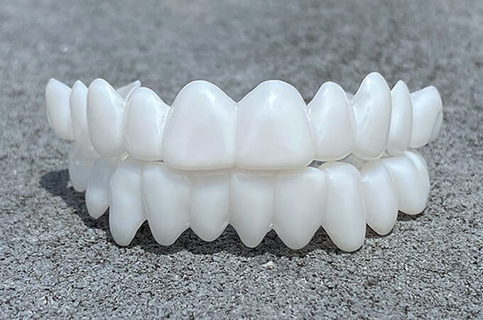 Dental Veneers for a Natural Fit and Comfortable Smile