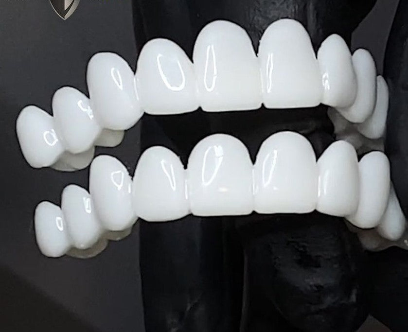 Dental Veneers for a Natural Fit and Comfortable Smile