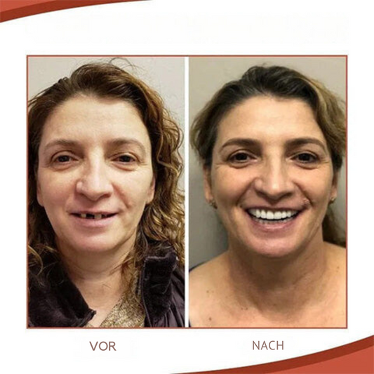 Biocompatible Prosthesis Kit for Comfortable Fit and Authentic Smile