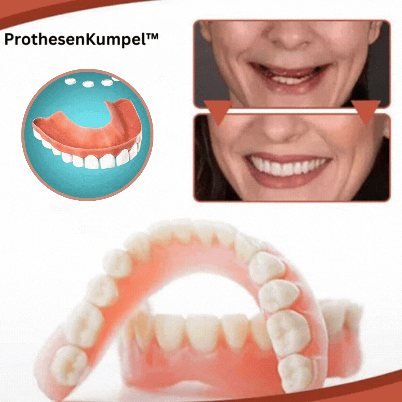 Biocompatible Prosthesis Kit for Comfortable Fit and Authentic Smile